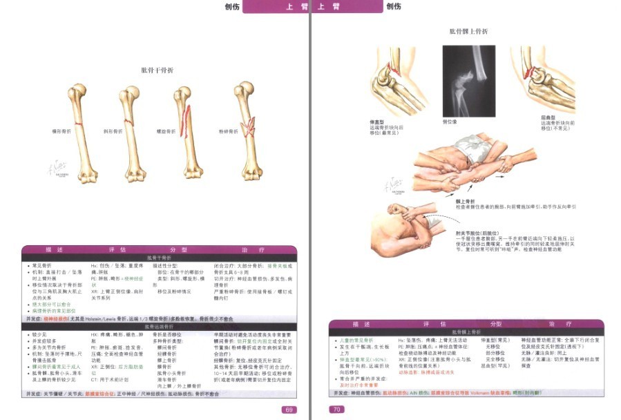 图片[6]-《奈特简明骨科学彩色图谱》高清中文版 450幅骨科解剖图 了解身体[pdf]-影音屋