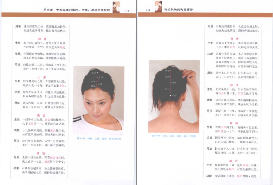 图片[3]-《针灸歌诀配彩色图谱》知识不白学 值得一读[pdf]-影音屋