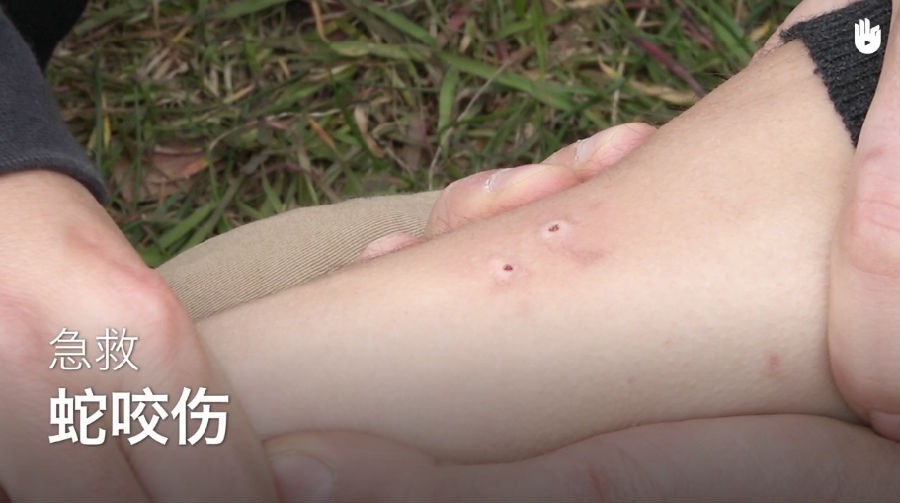 图片[3]-《41种急救技能》视频版 赶快学起来 关键时刻能救命[mp4]-影音屋