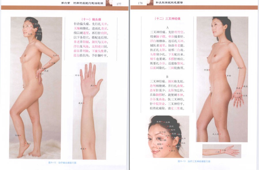 图片[5]-《针灸歌诀配彩色图谱》知识不白学 值得一读[pdf]-影音屋