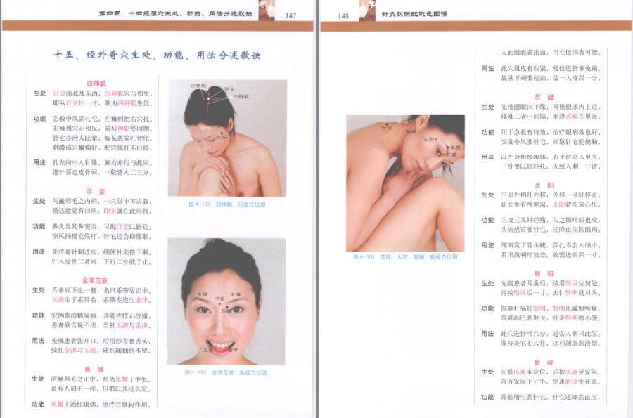 图片[4]-《针灸歌诀配彩色图谱》知识不白学 值得一读[pdf]-影音屋